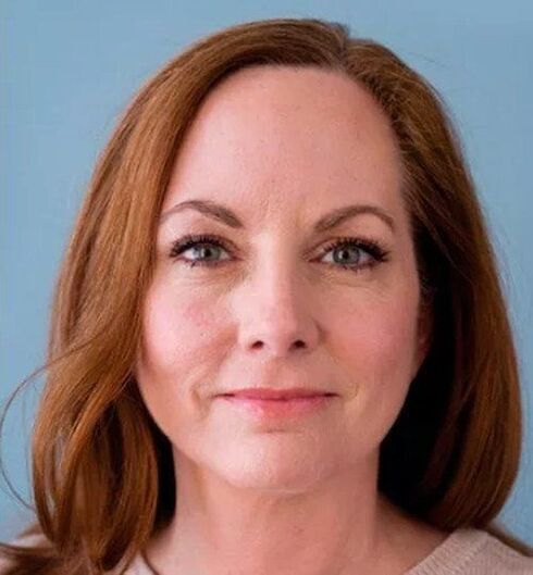 Après que le visage de Joanna ait utilisé la crème Eudalie, elle est transformée