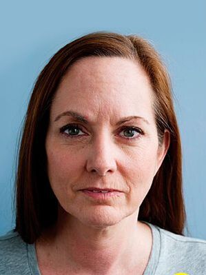 La peau de Joanna avant d'utiliser la crème Eudalie, a donné son âge