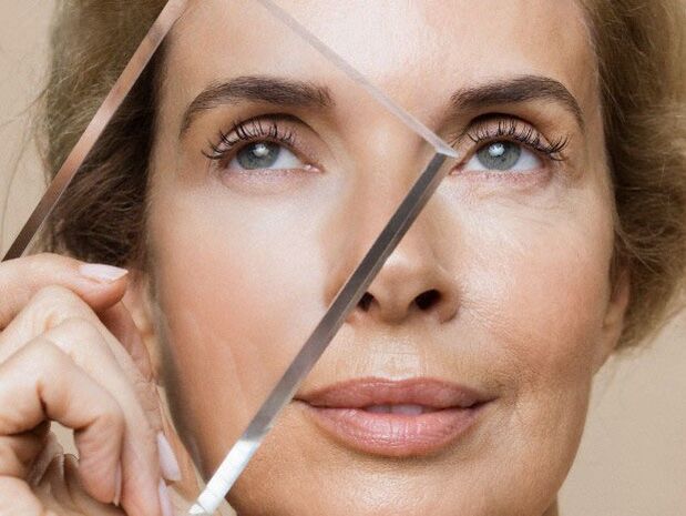 Rajeunissement du visage avec un processus laser