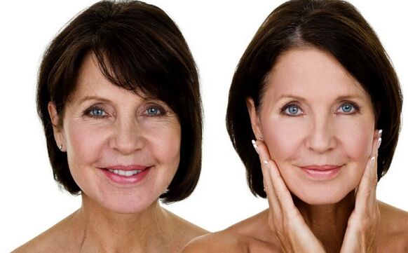 avant et après le rajeunissement de la peau du visage à la maison